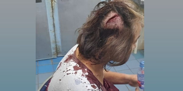 Mrs Mi Jung Kim Kang, 59, at the National Referral Hospital. She received a deep cut wound in the head. Photo supplied.