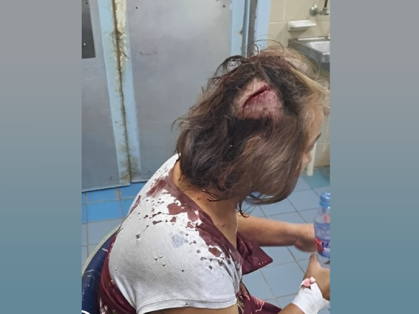Mrs Mi Jung Kim Kang, 59, at the National Referral Hospital. She received a deep cut wound in the head. Photo supplied.
