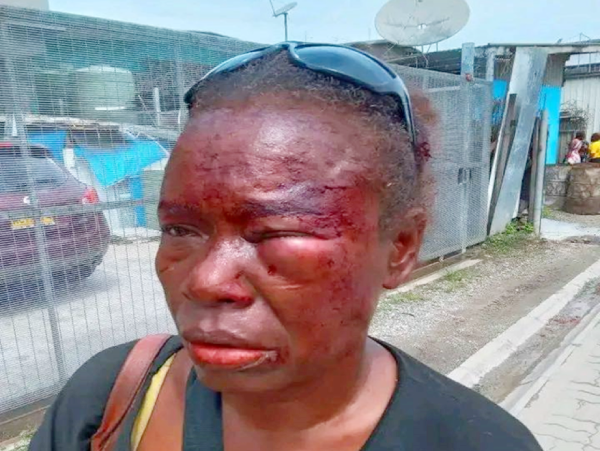 A victim of excessive force?