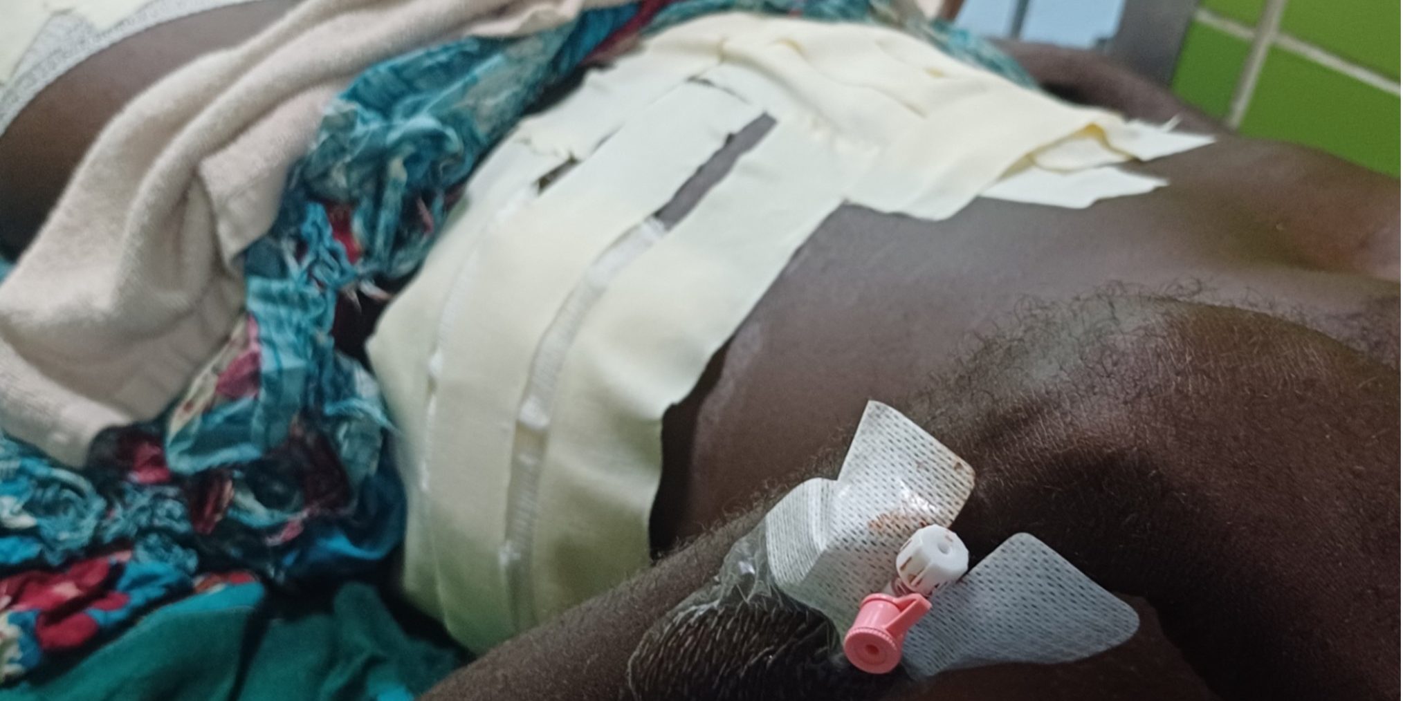 Mr Wale admitted slowly recovering at the NRH Surgical Ward