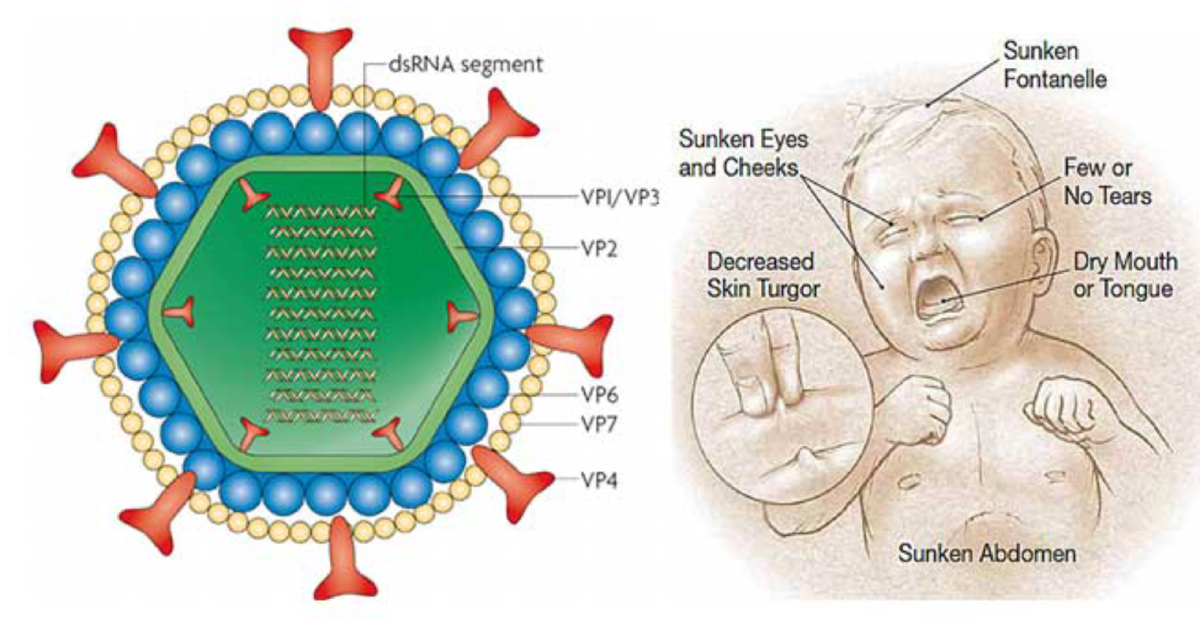 Rota virus cases detected, public urged to be vigilant Rota virus cases detected, public urged to be vigilant