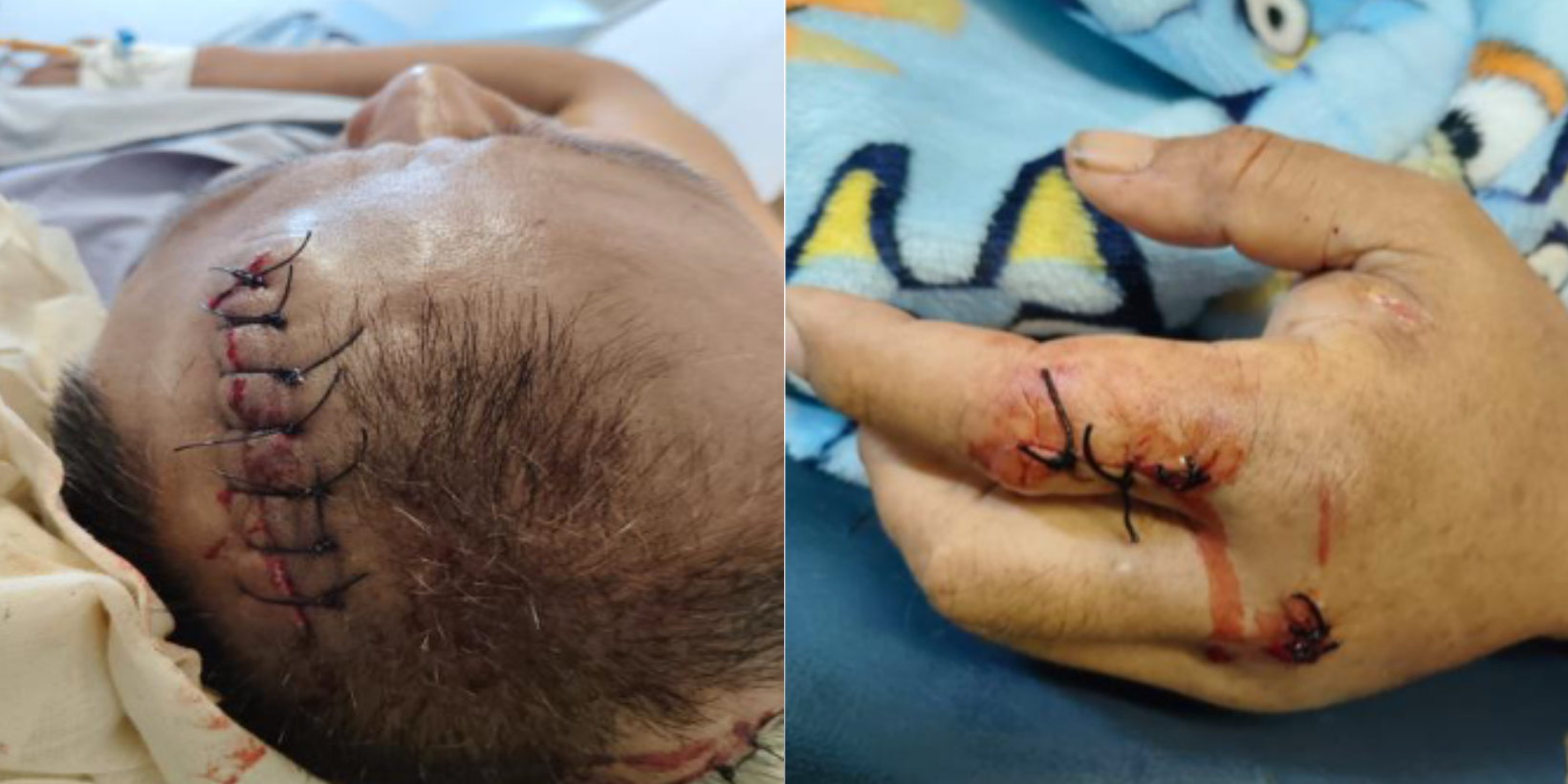 Construction attacked