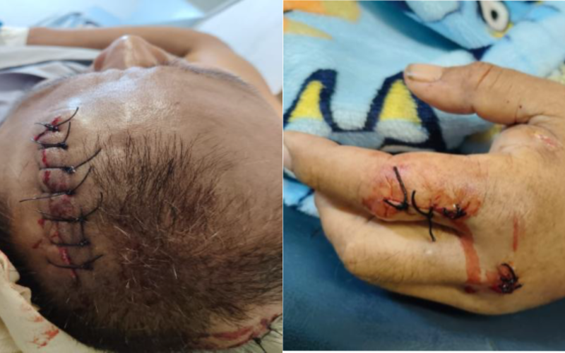 Construction worker attacked in N/Malaita