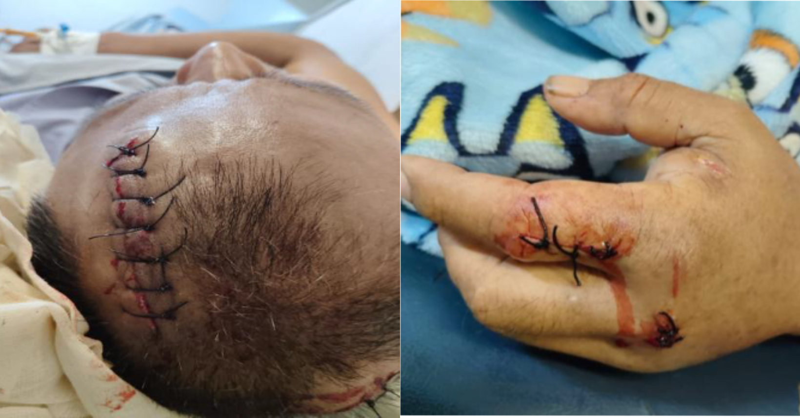 MALAITANS CONDEMN ALLEGED ASSAULT ON CCECC EMPLOYEE